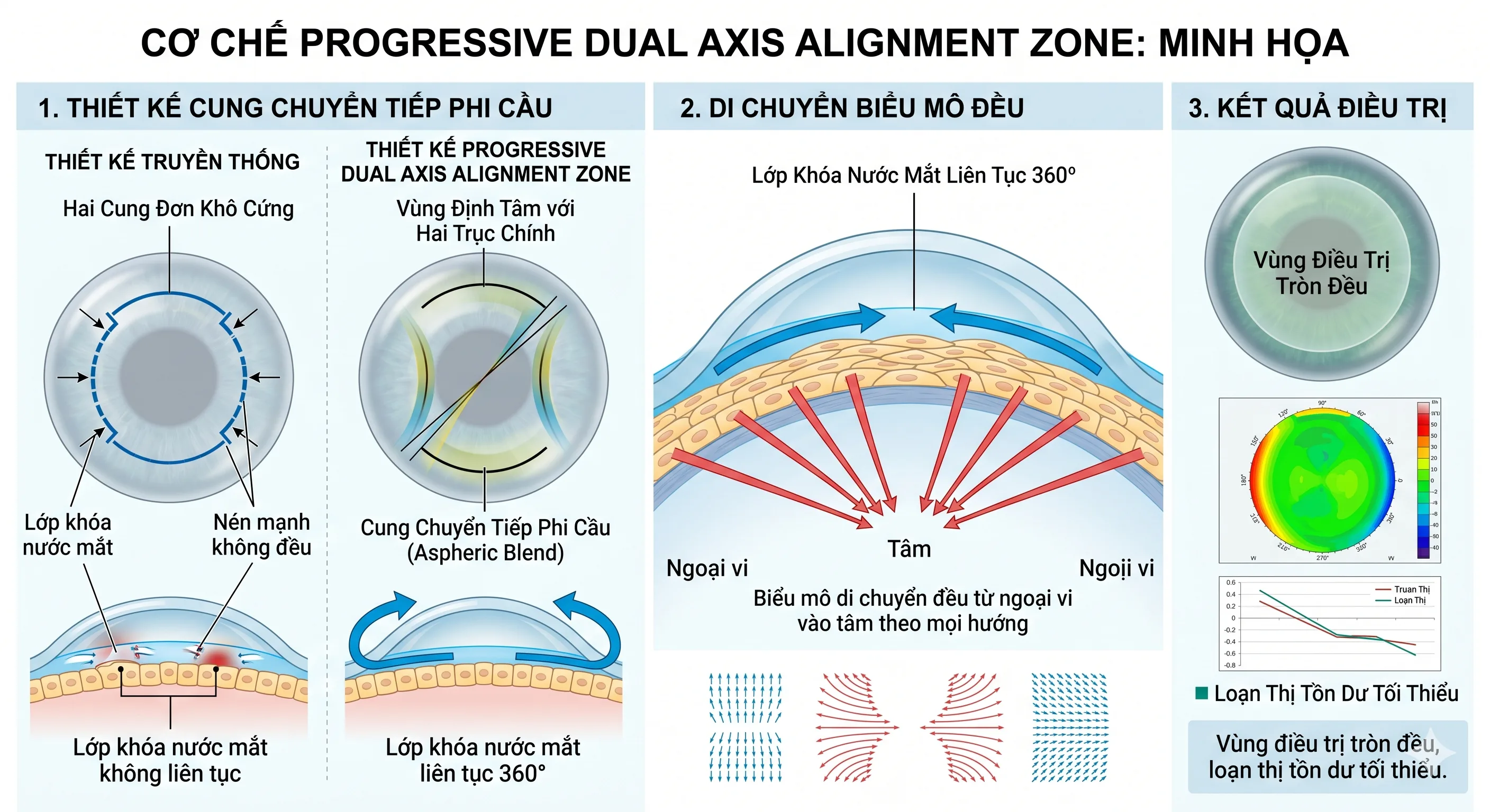 Cơ chế GOV® Dual — Progressive Dual Axis Alignment Zone